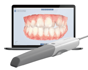 Aoralscan_3_Intraoral_Scanner-removebg-preview-300x239