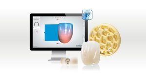 The Rise of CAD/CAM Technology in Dentistry