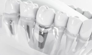 Cosmetic_Dentistry_1-300x106