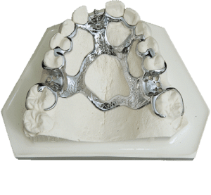 The-Revolution-of-3D-Printers-in-the-Dental-Sector-Image-PNG-2-300x277