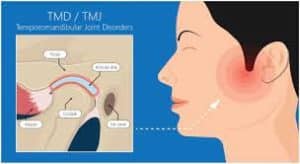 The Advanced Low Level Laser Therapy For Treating TMJ Disorders